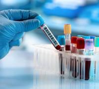 A importância dos exames de laboratório no diagnóstico de doenças
