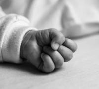 Em situação rara, médicos removem oito embriões de criança de 21 dias