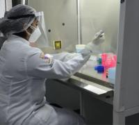 Universidade brasileira pede para testar em humanos terceira vacina