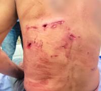 Homem atacado por onça-pintada é salvo por 5 cachorros de estimação