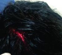 Adolescente é agredido com cabo de vassoura durante briga entre vizinhos