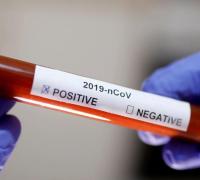 Gentio do Ouro confirma o 5º caso positivo de coronavírus