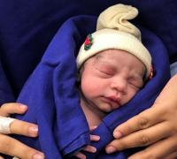 Primeiro bebê do mundo nascido via útero transplantado de doador morto