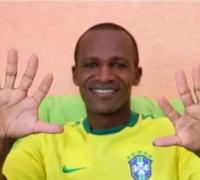 Baiano com seis dedos quer comemorar título para Brasil com uma mão