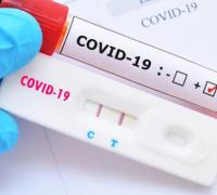Barra do Mendes registra primeiro caso positivo do novo coronavírus