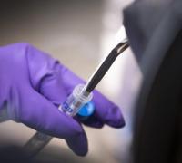 Cientistas identificam primeiro medicamento que comprovadamente reduz mortes por coronavírus