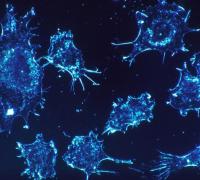 Novo tratamento para câncer de pâncreas começa a ser testado em humanos