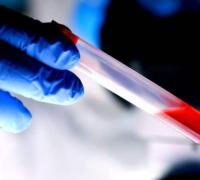 Novo tipo sanguíneo é descoberto após 40 anos de mistério