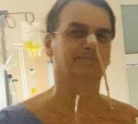 Bolsonaro volta a ter febre e é diagnosticado com pneumonia