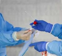 Bahia tem 431 casos de Covid-19 e 83 pacientes curados