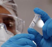 Casos de Covid-19 voltam a crescer no Brasil e acendem alerta dos médicos