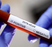 Bahia confirma oitavo caso do novo coronavírus