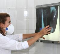 Pesquisadores vão testar vacina contra tuberculose em infectados