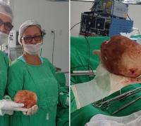 Lavrador de 51 anos tem pedra de 1,3 Kg e 18 cm retirada da bexiga durante cirurgia